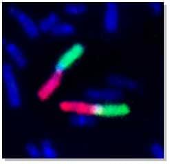 Human chromosome 1 arm painting probe