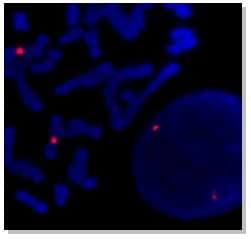 Human chromosome 3 centromere probe