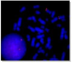 Human chromosome 1 subtelomere probes