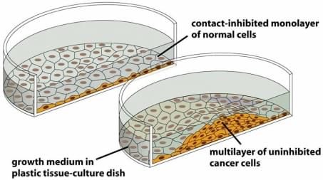 Tumor cell has loosed the contact inhibition.