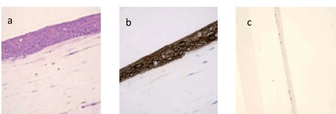 Histologic characterization of the 3D model of oral mucosa. (a) Morphologic characteristics (H&E staining). (b) Expression pattern of E-cadherin (immunohistochemical staining). (c) Expression pattern of Ki-67 (immunohistochemical staining).