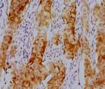 Immunohistochemistry(IHC)