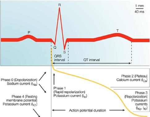 Figure 1, Temporal correlation between action potential duration and the QT interval on the surface ECG<sup>2</sup>. Typically, the P wave reflects atrial depolarization, the QRS complex reflects ventricular depolarization and the T wave reflects ventricular repolarization (Phase 3). Numerous overlapping ionic currents contribute to the morphology and duration of the ventricular action potential.