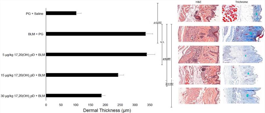 17,20S(OH)2pD decreases dermal thickness in BLM model of fibrosis. Left panel: quantification of the dermal thickness; middle panel: H&E stained sections; right panel: Trichrome stained sections.