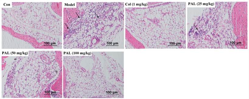 Hematoxylin and eosin staining of leukocytes in joint tissues (black arrow)