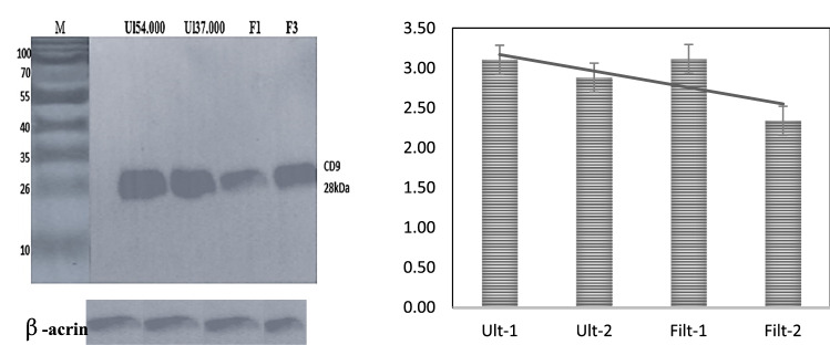 Band of 28 kDa of exosomes has been treated with CD9 of rabbit anti-mouse.