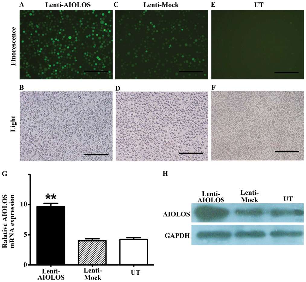 Fig. 3 Determination of lentiviral transduction efficiency and expression level of AIOLOS in Nalm-6 cells of the Lenti-AIOLOS group. (Zhuang Y, et al., 2014)