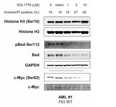 Immunoblot analysis of Pim kinase targets in AML primary cells treated with SGI-1776. (Chen LS, et al., 2011)