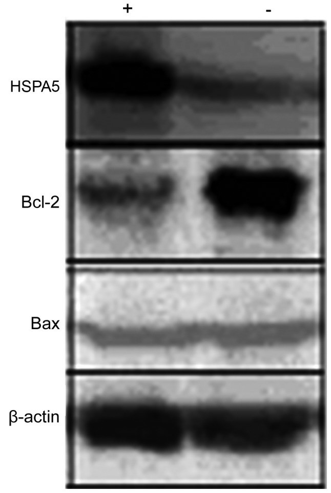 Western blot analysis of apoptosis-related proteins with β-actin as an equal loading control. (Li JJ, et al., 2017)