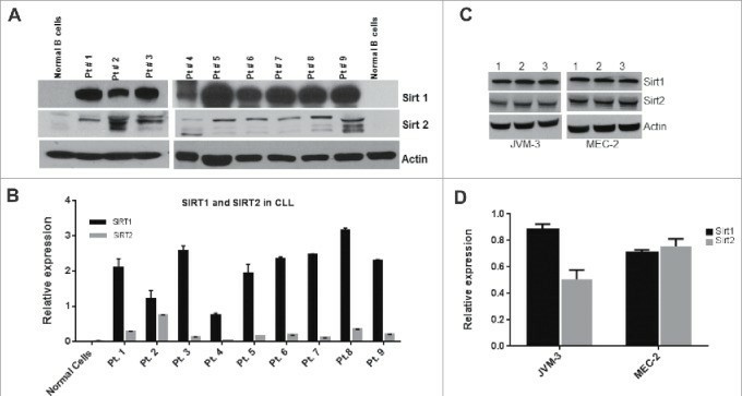 SIRT1 and SIRT2 are overexpressed in CLL cell lines (JVM-3 and MEC-2).