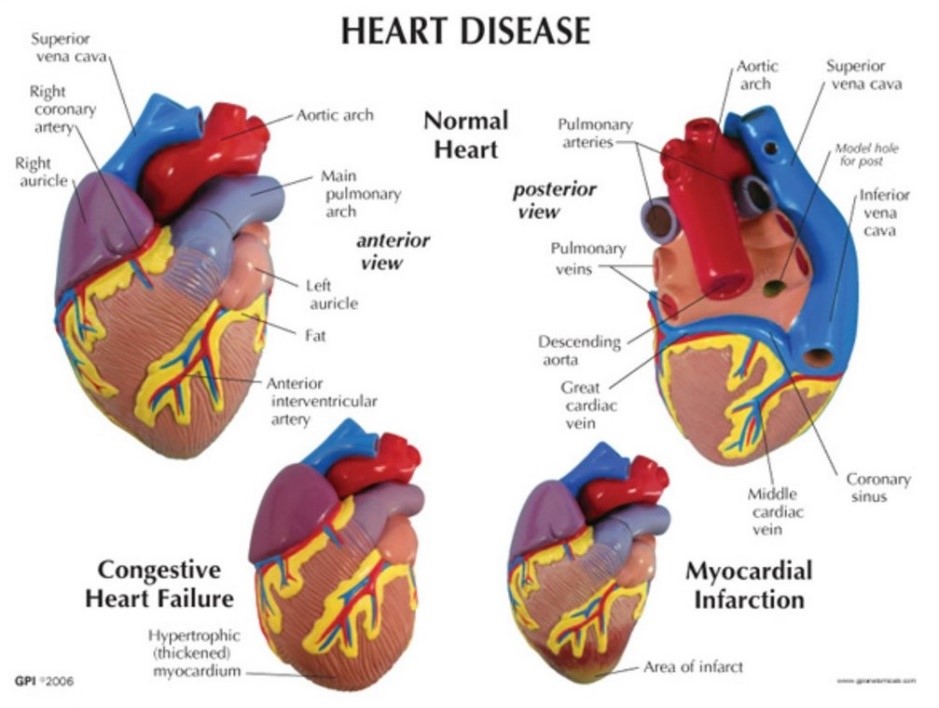 Cardiovascular Disease Models