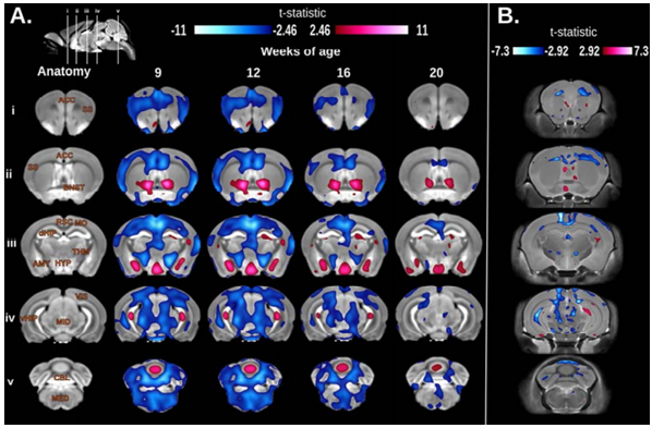 Longitudinal and cross-sectional voxel-wise differences between TgCRND8 (TG) and WT mice. A. Significant voxel-wise volume differences between TG and WT longitudinally scanned at 9, 12, 16 and 20 weeks of age. Areas of the brain highlighted in blue represent regions where TG mice were significantly smaller than WT at a particular age; red represent regions where TG are significantly larger than WT (t-statistic= ±2.46, 5% FDR). Top left: Sagittal image of the final non-linear average depicting the location of the coronal slice selection through the brain. Rows: Corresponding coronal slices in the rostral to caudal direction (iv). Columns: The first column: Labels of brain regions overlaid on the anatomy (AMY, amygdala; ACC, anterior cingulated cortex; BNST, bed nucleus of the stria terminalis; CBL, cerebellum; dHIP, dorsal hippocampus, vHIP, ventral hippocampus; HYP, hypothalamus; MED, medulla; MID, midbrain; MO, motor cortex; RSC, retrosplenial cortex; SS, somatosensory cortex; THM, thalamus; VIS, visual cortex). Columns 2-5: 9, 12, 16 and 20 weeks of age. B. Results from the cross-sectional volumetric analysis between TG and WT mice at 9, 12, 16, or 20 weeks of age (Blue: TG < WT; Red: TG > WT; t-statistic= ±2.92, 5% FDR) 