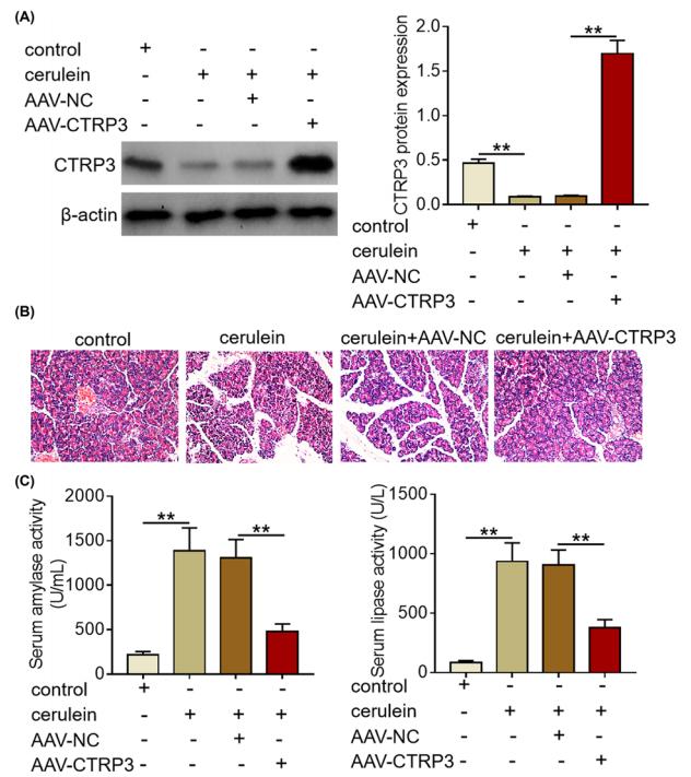 Fig. 1 CTRP3 overexpression alleviates pancreatic injury in cerulein-induced SAP mice.