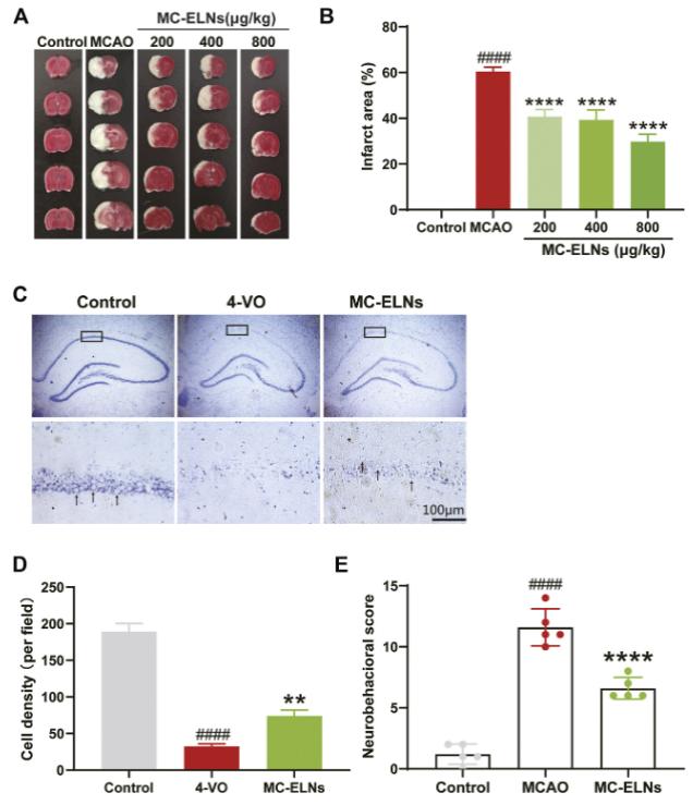 Fig. 2 MC-ELNs alleviate cerebral ischemia, promote hippocampus CA1 neuronal survival, and improve neurological function in transient cerebral ischemic rats.
