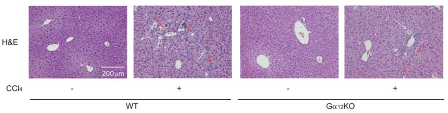 Liver fibrosis is inhibited by Gα12KO. H&E staining of liver tissue of different treatment group.