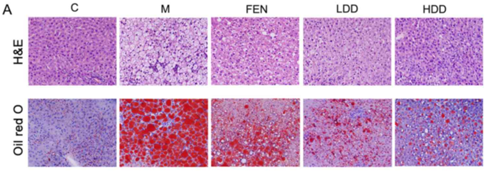 Diosgenin ameliorates the hepatic lipid accumulation in high-fat diet-fed rats. (A) Hematoxylin and eosin (H&E) and Oil red O staining of the rat liver.