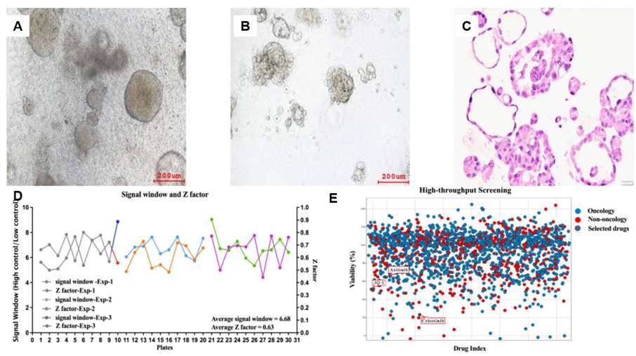 Fig. 3 Constructed Xp11.2 translocation RCC (RCCXp11.2) PDO model, representative brightfield (A-B) and HE staining (C) images. Establishment and evaluation of detection methods for fusion renal cancer (D). Primary screening of 1816 compounds in HTS assay (E).