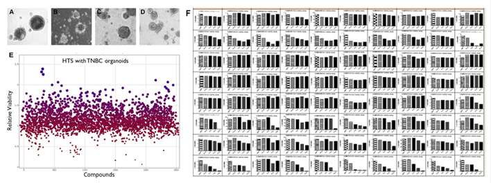 Fig. 3 Typical bright-field photographs (A-D) of PDOs in triple-negative breast cancer (TNBC). HTS results of TNBC-based PDOs (E). Response of TNBC-based PDOs to typical compounds (F).