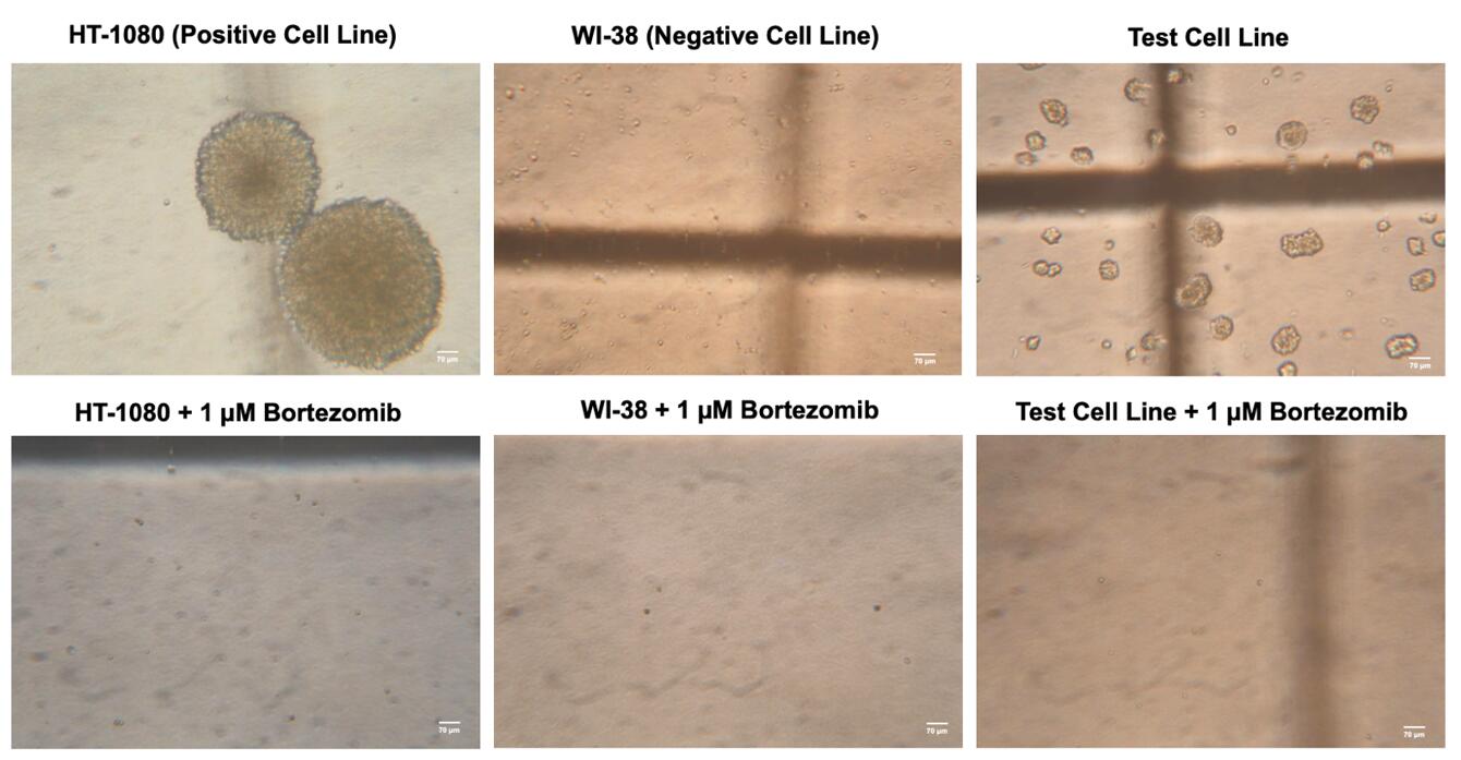 Images for the test cell line and positive and negative control cell lines with and without the addition of bortezomib at 1 µM in the soft agar assay (scale bar, 70 µm). 
