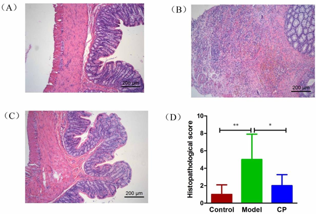 The pathological section of the colon tissues from rats in the (A) Control groups, (B) Model group, and (C) CP group, and (D) the histological score. The differences in (D) were analyzed using one-way ANOVA followed by Tukey's post hoc tests (* P < 0.05, ** P < 0.01). 