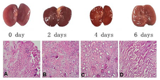 Histology changes of obstructed kidneys at (A) 0 day, (B) 2 days, (C) 4 days, and (D) 6 days