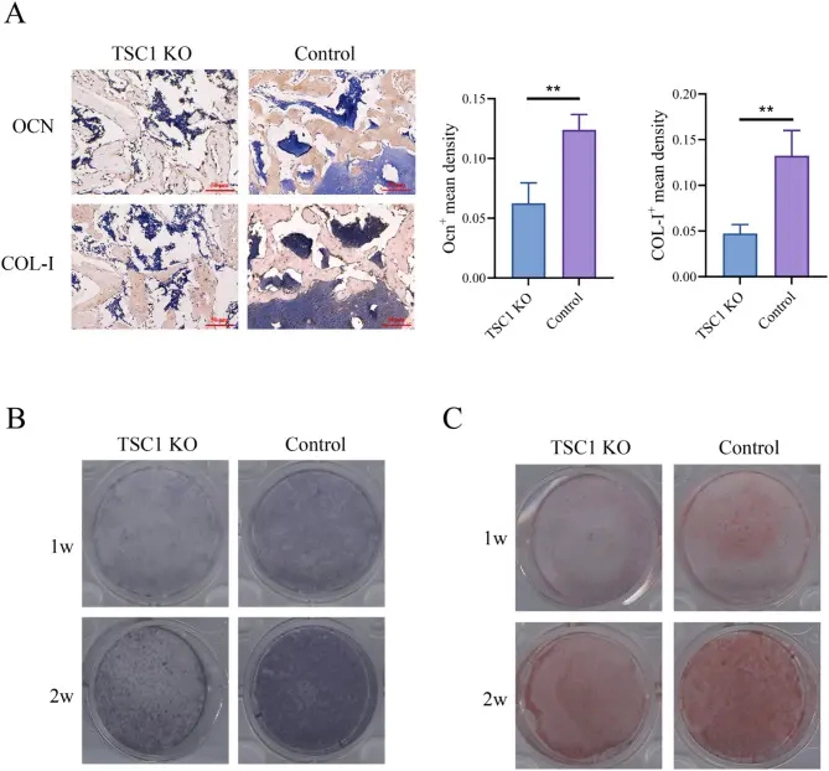 Activation of mTORC1 in mesenchymal cells inhibits their ability to differentiate into osteoblasts.