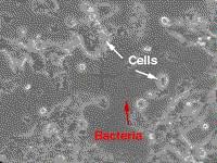 Cell contamination by bacteria.