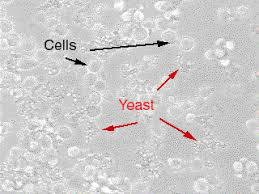 Cell contamination by yeast.