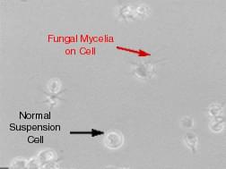 Cell contamination by Mold.