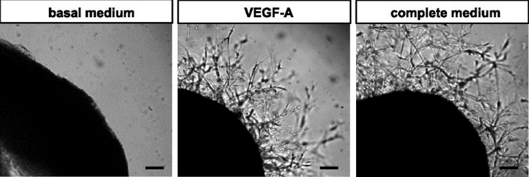 3D Angiogenesis Assay