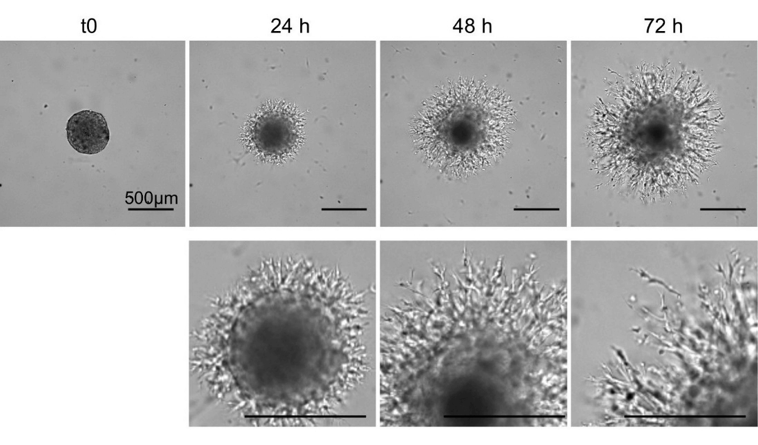 3D Invasion Assay