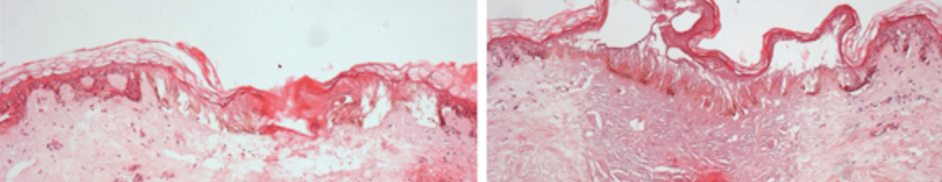 Ready-to-use ex vivo human skin models for cosmetic testing