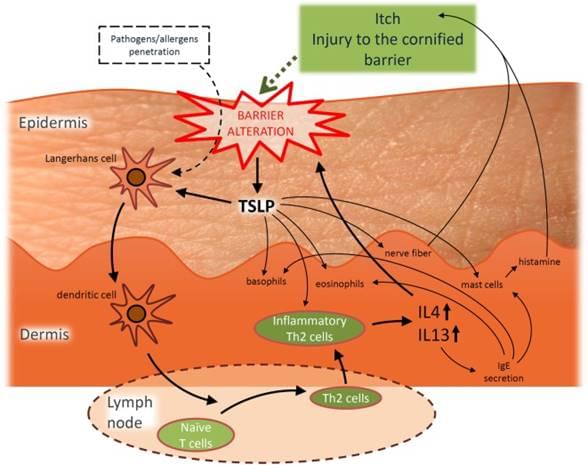 Atopic Dermatitis