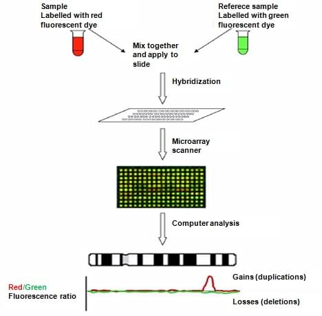 Molecular Karyotyping (aCGH) Service