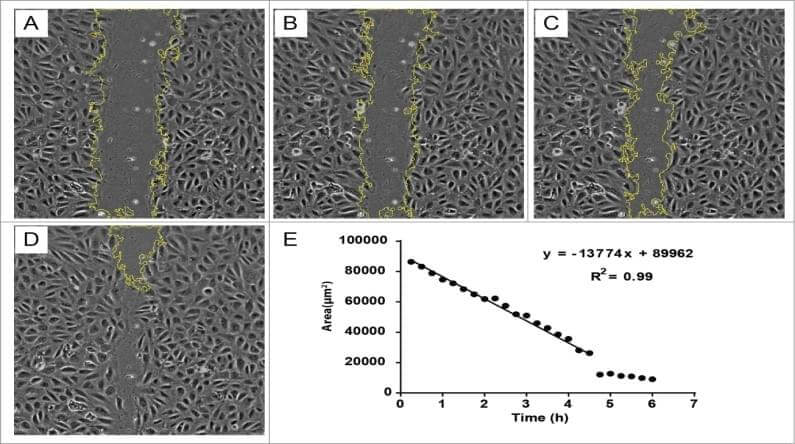 Results for wound-healing assays