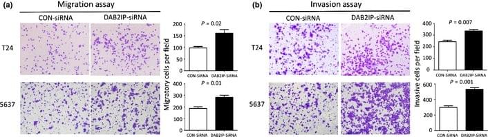 Transwell migration and invasion assays of T24 and  5637 bladder urothelial cancer cells