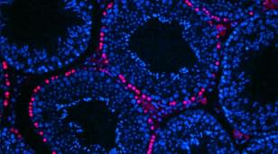 Cell Proliferation assay kits