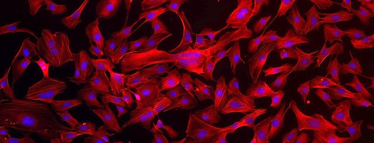 Endothelial Cells and Media