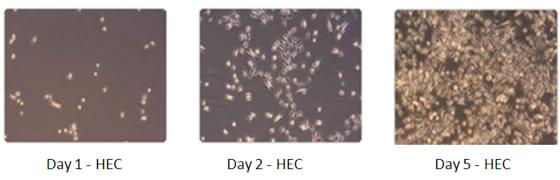 Epithelial Cell Growth Medium