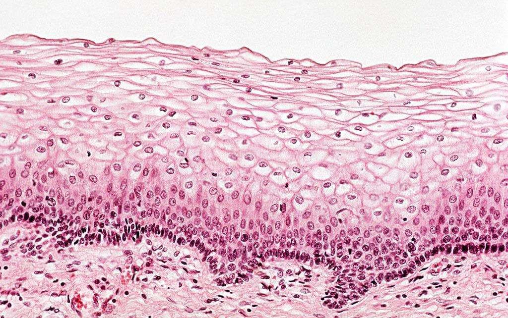 Epithelial Cells And Media