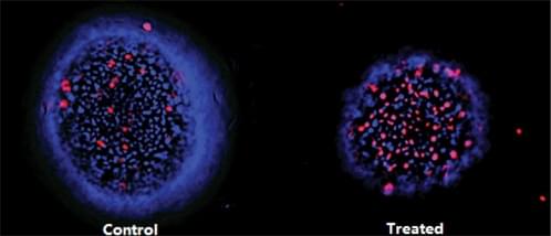 High Content Imaging (HCI) using 3D cell cultures