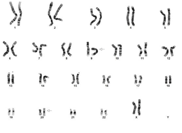 Chromosome Analysis of ES Cells and iPS Cells