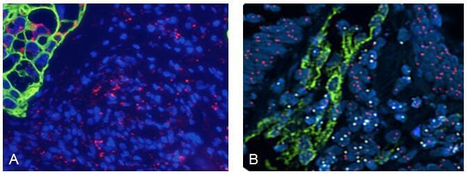 ImmunoFISH Analysis (FISH+IHC)