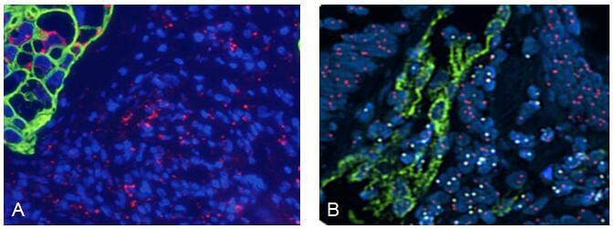 ImmunoFISH Analysis (FISH+IHC)