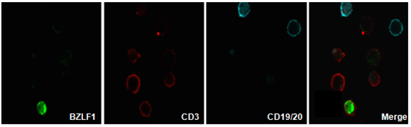 ImmunoFISH Analysis (FISH+IHC)