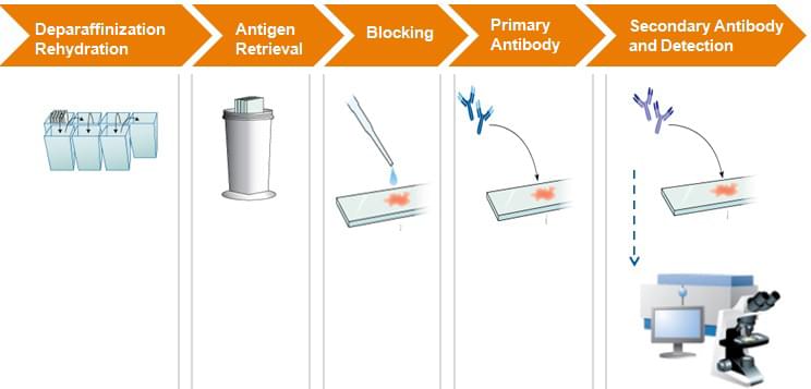 Immunohistochemistry Protocol