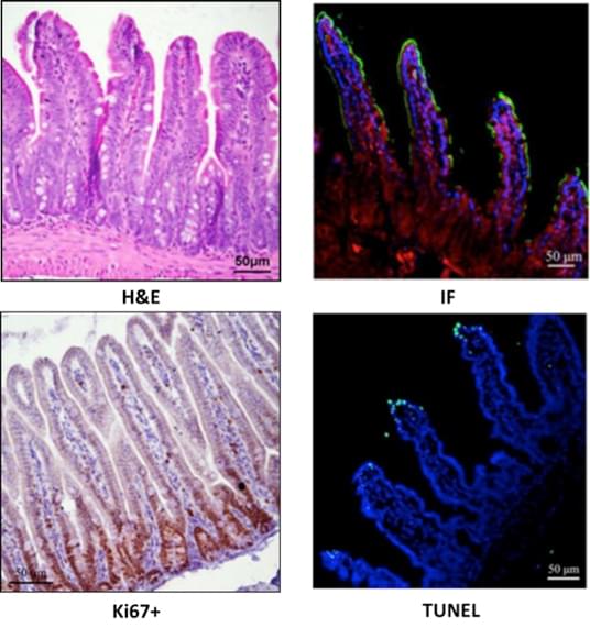 Immunohistochemistry