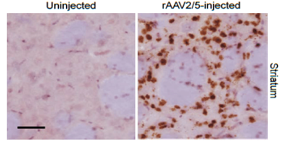 The in situ localization and distribution of rAAV Detection by RNA ISH. Scale bars= 5μm