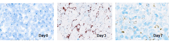 The in situ localization and distribution of CAR T Cells detection by RNA ISH.