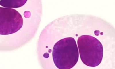 Presence of micronuclei next to the daughter nuclei